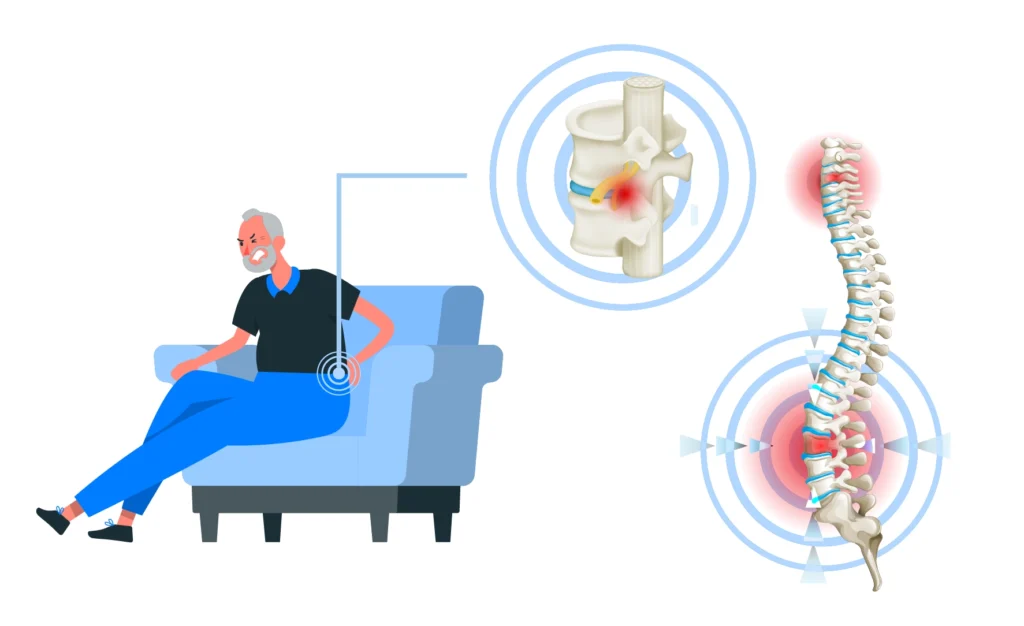 Ilustração de um homem sentado no sofá com dor nas costas se perguntando se hérnia de disco aposenta.